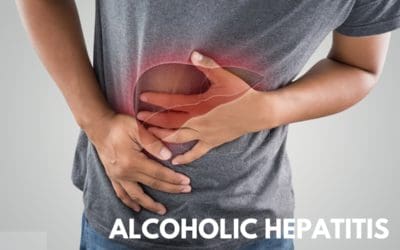 What You Should Know About Alcoholic Hepatitis