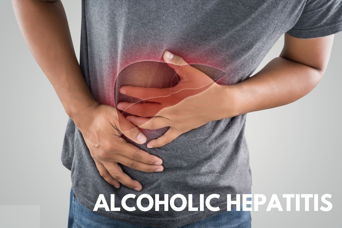 What you should know about alcoholic hepatitis