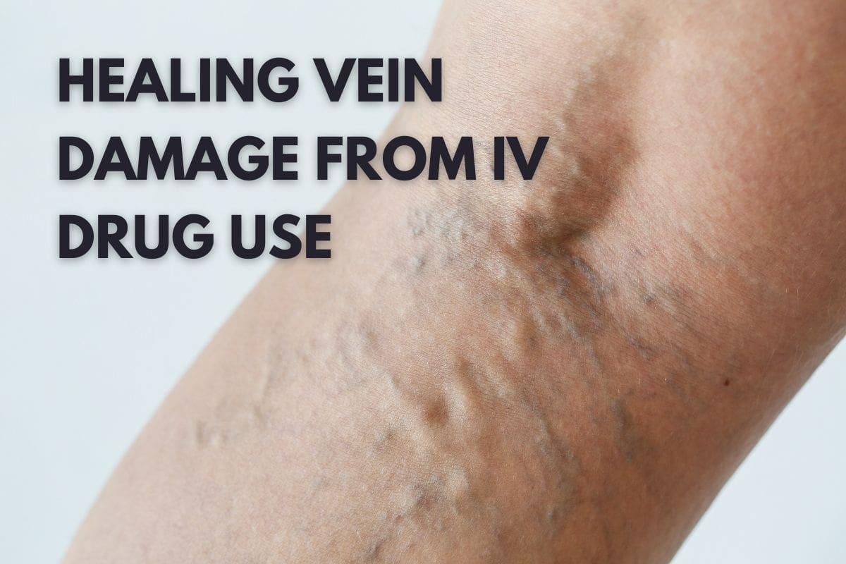 how-to-support-healing-vein-damage-from-iv-drug-use