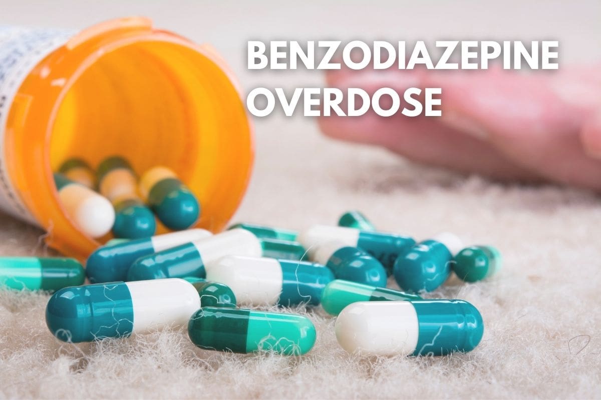 Can You Overdose on Benzodiazepines?